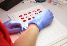 Де можна здати кров у серпні: графік виїзних донацій на Тернопільщині